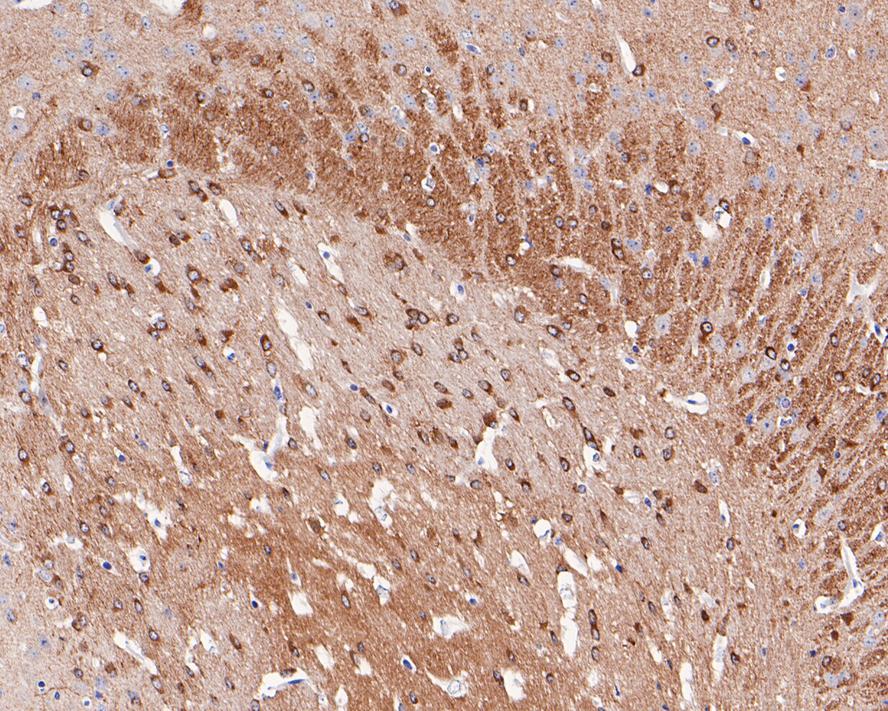 Immunohistochemical analysis of paraffin-embedded rat brain tissue using anti-Phospho-Tau(S396) antibody. The section was pre-treated using heat mediated antigen retrieval with Tris-EDTA buffer (pH 8.0-8.4) for 20 minutes.The tissues were blocked in 5% BSA for 30 minutes at room temperature, washed with ddH2O and PBS, and then probed with the primary antibody (ET1611-68, 1/50) for 30 minutes at room temperature. The detection was performed using an HRP conjugated compact polymer system. DAB was used as the chromogen. Tissues were counterstained with hematoxylin and mounted with DPX.