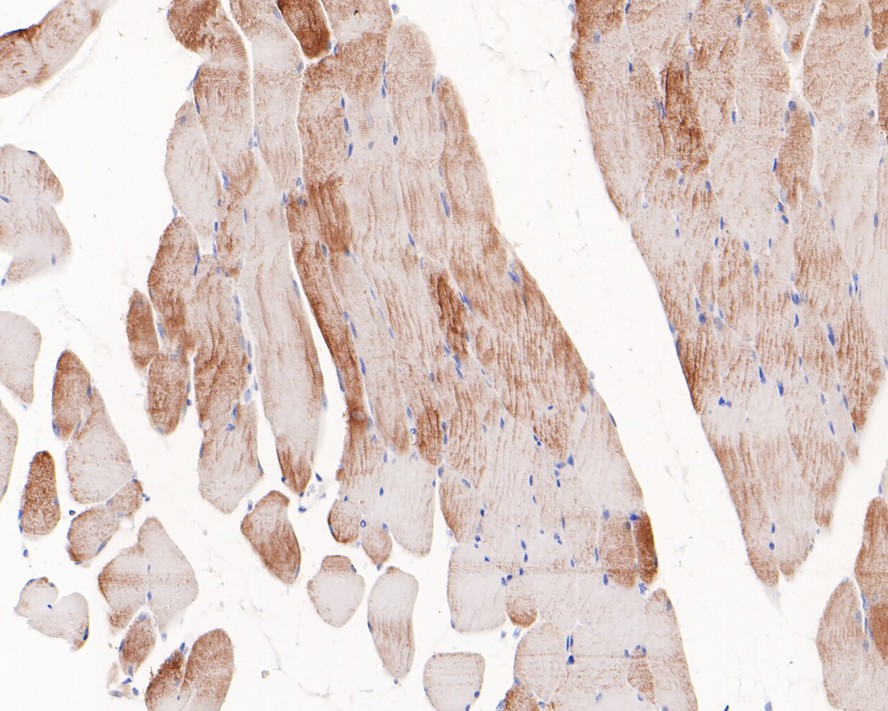 Immunohistochemical analysis of paraffin-embedded mouse skeletal muscle tissue with Rabbit anti-Phospho-Glycogen synthase 1(S641) antibody (ET1602-13) at 1/200 dilution.<br />
<br />
The section was pre-treated using heat mediated antigen retrieval with Tris-EDTA buffer (pH 9.0) for 20 minutes. The tissues were blocked in 1% BSA for 20 minutes at room temperature, washed with ddH2O and PBS, and then probed with the primary antibody (ET1602-13) at 1/200 dilution for 1 hour at room temperature. The detection was performed using an HRP conjugated compact polymer system. DAB was used as the chromogen. Tissues were counterstained with hematoxylin and mounted with DPX.