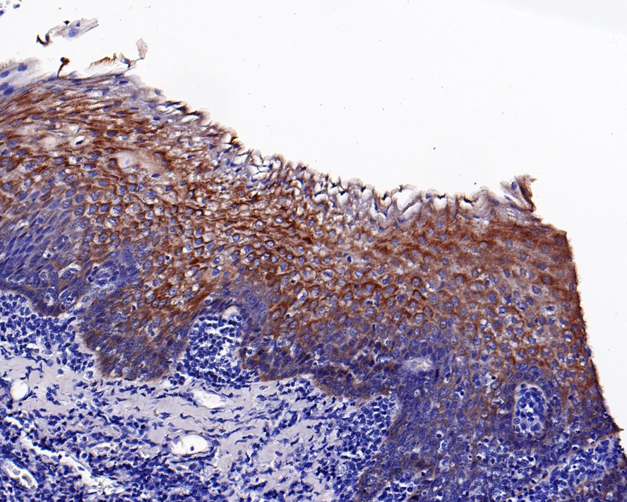 Immunohistochemical analysis of paraffin-embedded human tonsil tissue with Rabbit anti-Cytokeratin 4 antibody (ET1611-91) at 1/200 dilution.<br />
<br />
The section was pre-treated using heat mediated antigen retrieval with Tris-EDTA buffer (pH 9.0) for 20 minutes. The tissues were blocked in 1% BSA for 20 minutes at room temperature, washed with ddH2O and PBS, and then probed with the primary antibody (ET1611-91) at 1/200 dilution for 1 hour at room temperature. The detection was performed using an HRP conjugated compact polymer system. DAB was used as the chromogen. Tissues were counterstained with hematoxylin and mounted with DPX.