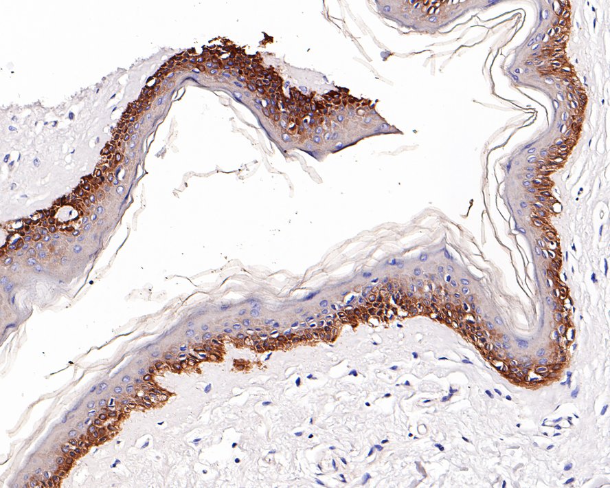 Immunohistochemical analysis of paraffin-embedded human skin tissue with Rabbit anti-Cytokeratin 4 antibody (ET1611-91) at 1/200 dilution.<br />
<br />
The section was pre-treated using heat mediated antigen retrieval with Tris-EDTA buffer (pH 9.0) for 20 minutes. The tissues were blocked in 1% BSA for 20 minutes at room temperature, washed with ddH2O and PBS, and then probed with the primary antibody (ET1611-91) at 1/200 dilution for 1 hour at room temperature. The detection was performed using an HRP conjugated compact polymer system. DAB was used as the chromogen. Tissues were counterstained with hematoxylin and mounted with DPX.