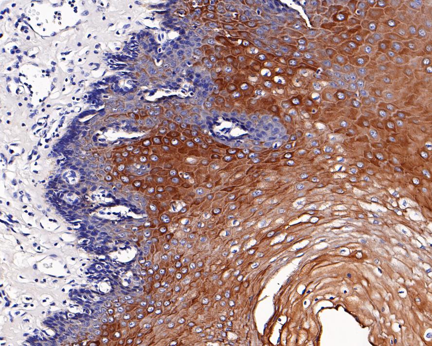 Immunohistochemical analysis of paraffin-embedded human esophagus tissue with Rabbit anti-Cytokeratin 4 antibody (ET1611-91) at 1/200 dilution.<br />
<br />
The section was pre-treated using heat mediated antigen retrieval with Tris-EDTA buffer (pH 9.0) for 20 minutes. The tissues were blocked in 1% BSA for 20 minutes at room temperature, washed with ddH2O and PBS, and then probed with the primary antibody (ET1611-91) at 1/200 dilution for 1 hour at room temperature. The detection was performed using an HRP conjugated compact polymer system. DAB was used as the chromogen. Tissues were counterstained with hematoxylin and mounted with DPX.