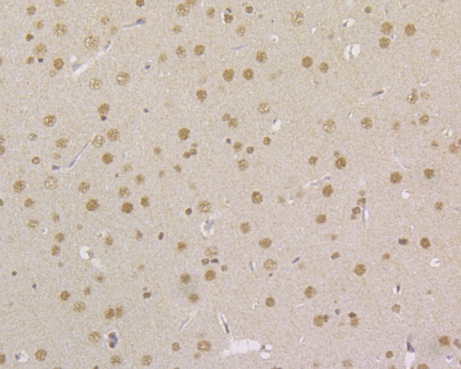 Immunohistochemical analysis of paraffin-embedded rat brain tissue using anti-MSH2 antibody. The section was pre-treated using heat mediated antigen retrieval with sodium citrate buffer (pH 6.0) for 20 minutes. The tissues were blocked in 5% BSA for 30 minutes at room temperature, washed with ddH2O and PBS, and then probed with the primary antibody (EM1801-04, 1/200)  for 30 minutes at room temperature. The detection was performed using an HRP conjugated compact polymer system. DAB was used as the chromogen. Tissues were counterstained with hematoxylin and mounted with DPX.