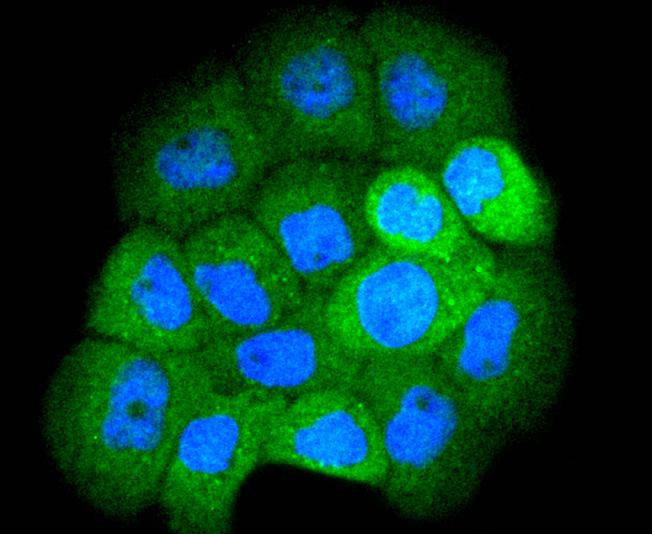 ICC staining of Smad1 in A431 cells (green). Formalin fixed cells were permeabilized with 0.1% Triton X-100 in TBS for 10 minutes at room temperature and blocked with 1% Blocker BSA for 15 minutes at room temperature. Cells were probed with the primary antibody (ET1607-42, 1/50) for 1 hour at room temperature, washed with PBS. Alexa Fluor®488 Goat anti-Rabbit IgG was used as the secondary antibody at 1/1,000 dilution. The nuclear counter stain is DAPI (blue).