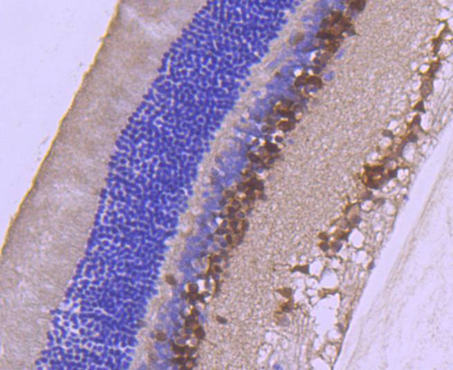 Immunohistochemical analysis of paraffin-embedded mouse pancreas tissue using anti-PAX6 antibody. The section was pre-treated using heat mediated antigen retrieval with Tris-EDTA buffer (pH 8.0-8.4) for 20 minutes.The tissues were blocked in 5% BSA for 30 minutes at room temperature, washed with ddH2O and PBS, and then probed with the primary antibody (ET1612-89, 1/50) for 30 minutes at room temperature. The detection was performed using an HRP conjugated compact polymer system. DAB was used as the chromogen. Tissues were counterstained with hematoxylin and mounted with DPX.