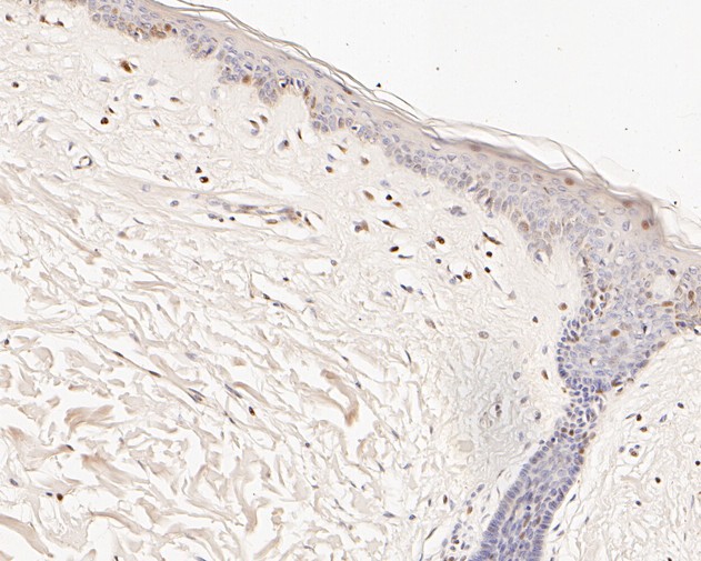 Immunohistochemical analysis of paraffin-embedded human cervix uteri tissue using anti-pro Caspase-9 antibody. The section was pre-treated using heat mediated antigen retrieval with sodium citrate buffer (pH 6.0) for 20 minutes. The tissues were blocked in 5% BSA for 30 minutes at room temperature, washed with ddH2O and PBS, and then probed with the primary antibody (ET1701-22, 1/100) for 30 minutes at room temperature. The detection was performed using an HRP conjugated compact polymer system. DAB was used as the chromogen. Tissues were counterstained with hematoxylin and mounted with DPX.