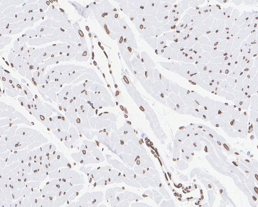 Immunohistochemical analysis of paraffin-embedded human tonsil tissue using anti-E2F1 antibody. The section was pre-treated using heat mediated antigen retrieval with sodium citrate buffer (pH 6.0) for 20 minutes. The tissues were blocked in 5% BSA for 30 minutes at room temperature, washed with ddH2O and PBS, and then probed with the primary antibody (ET1701-73, 1/50)  for 30 minutes at room temperature. The detection was performed using an HRP conjugated compact polymer system. DAB was used as the chromogen. Tissues were counterstained with hematoxylin and mounted with DPX.