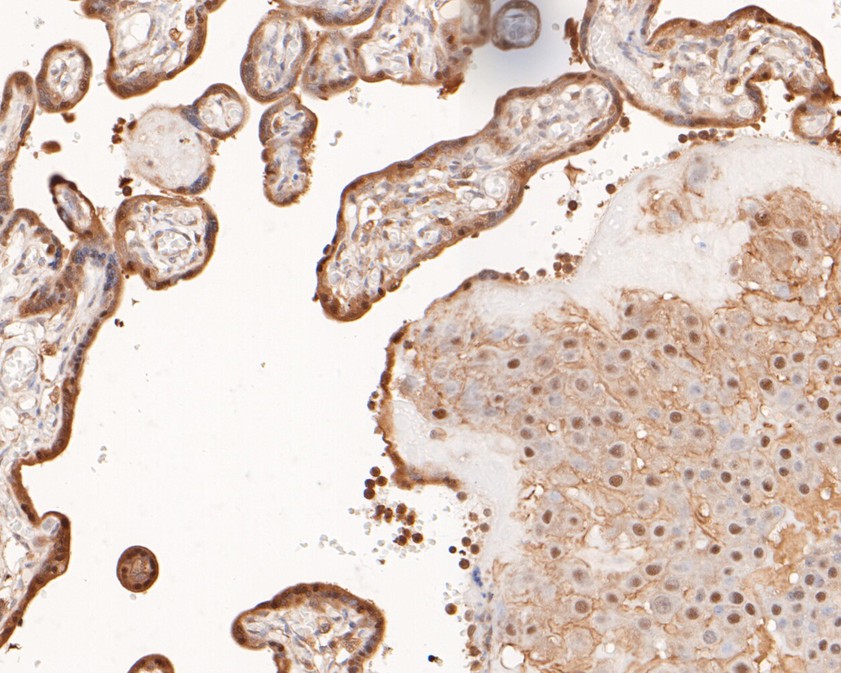 Immunohistochemical analysis of paraffin-embedded human placenta tissue using anti-c-Fos antibody. The section was pre-treated using heat mediated antigen retrieval with sodium citrate buffer (pH 6.0) for 20 minutes. The tissues were blocked in 5% BSA for 30 minutes at room temperature, washed with ddH2O and PBS, and then probed with the primary antibody (ET1701-95, 1/200)  for 30 minutes at room temperature. The detection was performed using an HRP conjugated compact polymer system. DAB was used as the chromogen. Tissues were counterstained with hematoxylin and mounted with DPX.