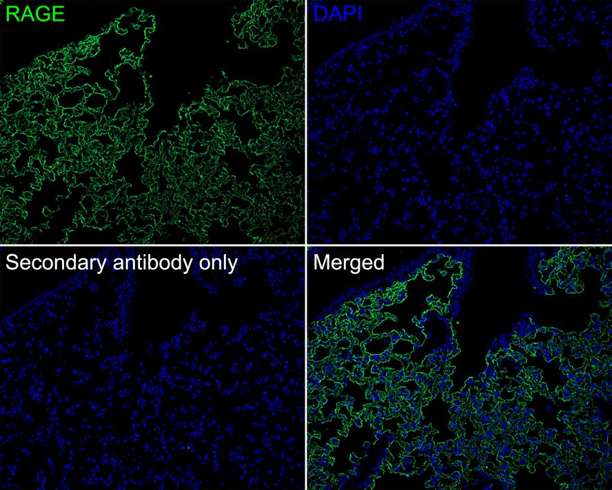 Immunofluorescence analysis of paraffin-embedded rat lung tissue (perfusion) labeling RAGE with Rabbit anti-RAGE antibody (ET1702-27) at 1/100 dilution.<br />
<br />
The section was pre-treated using heat mediated antigen retrieval with Tris-EDTA buffer (pH 9.0) for 20 minutes. The tissues were blocked in 10% negative goat serum for 1 hour at room temperature, washed with PBS, and then probed with the primary antibody (ET1702-27, green) at 1/100 dilution overnight at 4 ℃, washed with PBS.<br />
<br />
Goat Anti-Rabbit IgG H&L (iFluor™ 488, HA1121) was used as the secondary antibody at 1/1,000 dilution. Nuclei were counterstained with DAPI (blue).