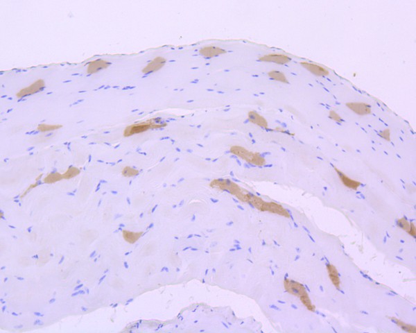 Immunohistochemical analysis of paraffin-embedded mouse smooth muscle tissue using anti-Myosin heavy chain antibody. The section was pre-treated using heat mediated antigen retrieval with Tris-EDTA buffer (pH 8.0-8.4) for 20 minutes.The tissues were blocked in 5% BSA for 30 minutes at room temperature, washed with ddH2O and PBS, and then probed with the primary antibody (ET1702-88, 1/200) for 30 minutes at room temperature. The detection was performed using an HRP conjugated compact polymer system. DAB was used as the chromogen. Tissues were counterstained with hematoxylin and mounted with DPX.
