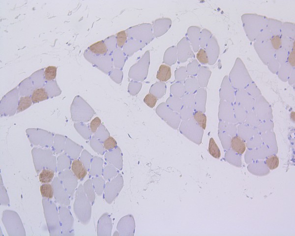 Immunohistochemical analysis of paraffin-embedded mouse skeletal muscle tissue using anti-Myosin heavy chain antibody. The section was pre-treated using heat mediated antigen retrieval with Tris-EDTA buffer (pH 8.0-8.4) for 20 minutes.The tissues were blocked in 5% BSA for 30 minutes at room temperature, washed with ddH2O and PBS, and then probed with the primary antibody (ET1702-88, 1/400) for 30 minutes at room temperature. The detection was performed using an HRP conjugated compact polymer system. DAB was used as the chromogen. Tissues were counterstained with hematoxylin and mounted with DPX.