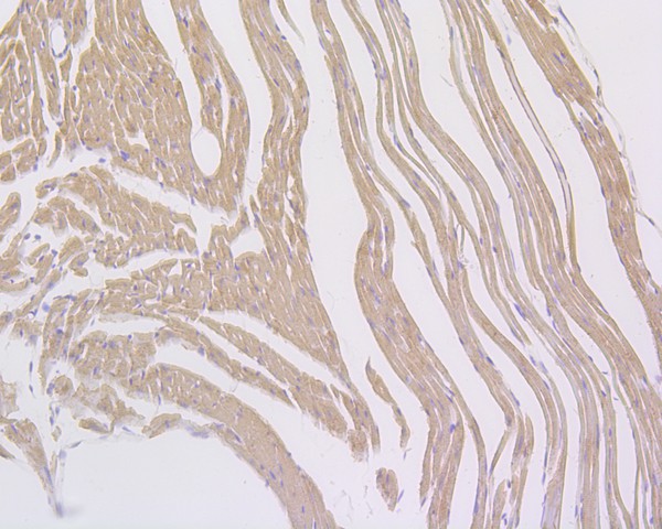 Immunohistochemical analysis of paraffin-embedded mouse heart tissue using anti-Myosin heavy chain antibody. The section was pre-treated using heat mediated antigen retrieval with Tris-EDTA buffer (pH 8.0-8.4) for 20 minutes.The tissues were blocked in 5% BSA for 30 minutes at room temperature, washed with ddH2O and PBS, and then probed with the primary antibody (ET1702-88, 1/400) for 30 minutes at room temperature. The detection was performed using an HRP conjugated compact polymer system. DAB was used as the chromogen. Tissues were counterstained with hematoxylin and mounted with DPX.
