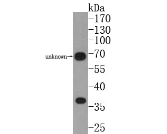 Western blot analysis of CD24 on mouse thymus tissue lysates. Proteins were transferred to a PVDF membrane and blocked with 5% BSA in PBS for 1 hour at room temperature. The primary antibody (0804-3, 1/1000) was used in 5% BSA at room temperature for 2 hours. Goat Anti-Rabbit IgG - HRP Secondary Antibody (HA1001) at 1:200,000 dilution was used for 1 hour at room temperature.
