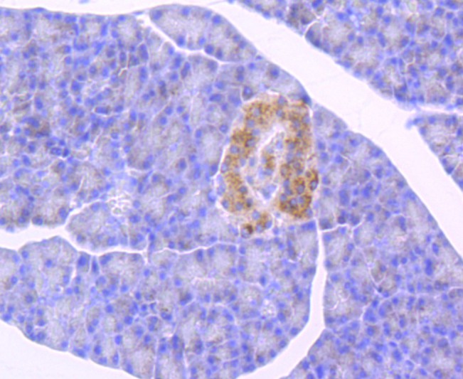 Immunohistochemical analysis of paraffin-embedded mouse pancreas tissue using anti-GBA antibody. The section was pre-treated using heat mediated antigen retrieval with Tris-EDTA buffer (pH 8.0-8.4) for 20 minutes.The tissues were blocked in 5% BSA for 30 minutes at room temperature, washed with ddH2O and PBS, and then probed with the primary antibody (ET1703-32, 1/50) for 30 minutes at room temperature. The detection was performed using an HRP conjugated compact polymer system. DAB was used as the chromogen. Tissues were counterstained with hematoxylin and mounted with DPX.