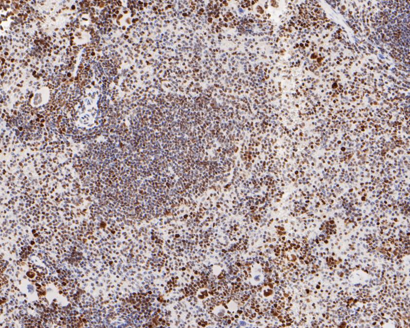 Immunohistochemical analysis of paraffin-embedded mouse spleen tissue with Mouse anti-MSH6 antibody (EM1902-24) at 1/200 dilution.<br />
<br />
The section was pre-treated using heat mediated antigen retrieval with sodium citrate buffer (pH 6.0) for 2 minutes. The tissues were blocked in 1% BSA for 20 minutes at room temperature, washed with ddH2O and PBS, and then probed with the primary antibody (EM1902-24) at 1/200 dilution for 1 hour at room temperature. The detection was performed using an HRP conjugated compact polymer system. DAB was used as the chromogen. Tissues were counterstained with hematoxylin and mounted with DPX.
