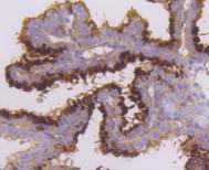 Immunohistochemical analysis of paraffin-embedded mouse placenta tissue using anti-Mst2 antibody. The section was pre-treated using heat mediated antigen retrieval with Tris-EDTA buffer (pH 8.0-8.4) for 20 minutes.The tissues were blocked in 5% BSA for 30 minutes at room temperature, washed with ddH2O and PBS, and then probed with the primary antibody (ET1610-8, 1/50) for 30 minutes at room temperature. The detection was performed using an HRP conjugated compact polymer system. DAB was used as the chromogen. Tissues were counterstained with hematoxylin and mounted with DPX.