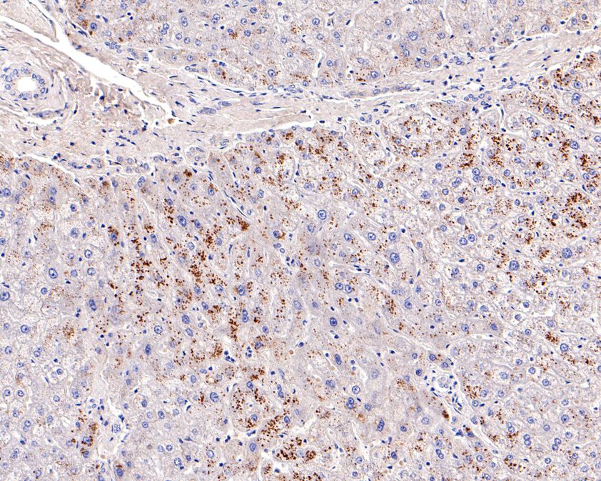 Immunohistochemical analysis of paraffin-embedded human liver tissue using anti-Factor H antibody. The section was pre-treated using heat mediated antigen retrieval with Tris-EDTA buffer (pH 8.0-8.4) for 20 minutes.The tissues were blocked in 5% BSA for 30 minutes at room temperature, washed with ddH2O and PBS, and then probed with the primary antibody (ET1704-83, 1/100) for 30 minutes at room temperature. The detection was performed using an HRP conjugated compact polymer system. DAB was used as the chromogen. Tissues were counterstained with hematoxylin and mounted with DPX.