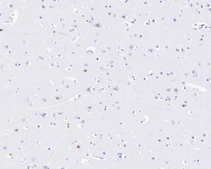 Immunohistochemical analysis of paraffin-embedded mouse brain tissue using anti-Estrogen Related Receptor alpha antibody. The section was pre-treated using heat mediated antigen retrieval with Tris-EDTA buffer (pH 8.0-8.4) for 20 minutes.The tissues were blocked in 5% BSA for 30 minutes at room temperature, washed with ddH2O and PBS, and then probed with the primary antibody (ET1610-14, 1/200) for 30 minutes at room temperature. The detection was performed using an HRP conjugated compact polymer system. DAB was used as the chromogen. Tissues were counterstained with hematoxylin and mounted with DPX.