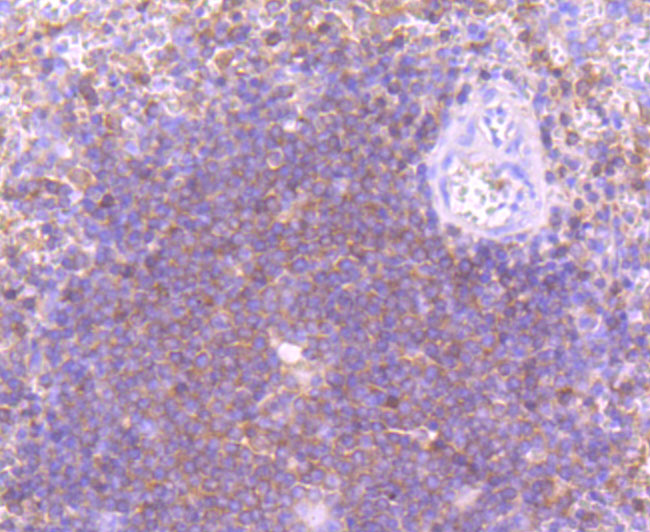 Immunohistochemical analysis of paraffin-embedded human spleen tissue using anti-PI 3 Kinase p110 delta antibody. The section was pre-treated using heat mediated antigen retrieval with Tris-EDTA buffer (pH 8.0-8.4) for 20 minutes.The tissues were blocked in 5% BSA for 30 minutes at room temperature, washed with ddH2O and PBS, and then probed with the primary antibody (ET1705-46, 1/50) for 30 minutes at room temperature. The detection was performed using an HRP conjugated compact polymer system. DAB was used as the chromogen. Tissues were counterstained with hematoxylin and mounted with DPX.