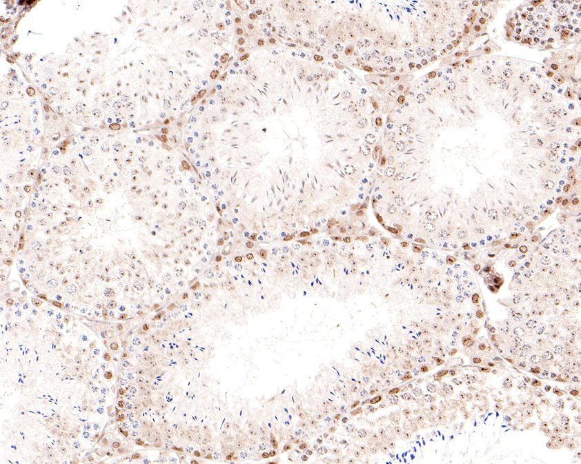 Immunohistochemical analysis of paraffin-embedded mouse testis tissue using anti-HP1 gamma antibody. The section was pre-treated using heat mediated antigen retrieval with sodium citrate buffer (pH 6.0) for 20 minutes. The tissues were blocked in 5% BSA for 30 minutes at room temperature, washed with ddH2O and PBS, and then probed with the primary antibody (ET1706-02, 1/200)  for 30 minutes at room temperature. The detection was performed using an HRP conjugated compact polymer system. DAB was used as the chromogen. Tissues were counterstained with hematoxylin and mounted with DPX.
