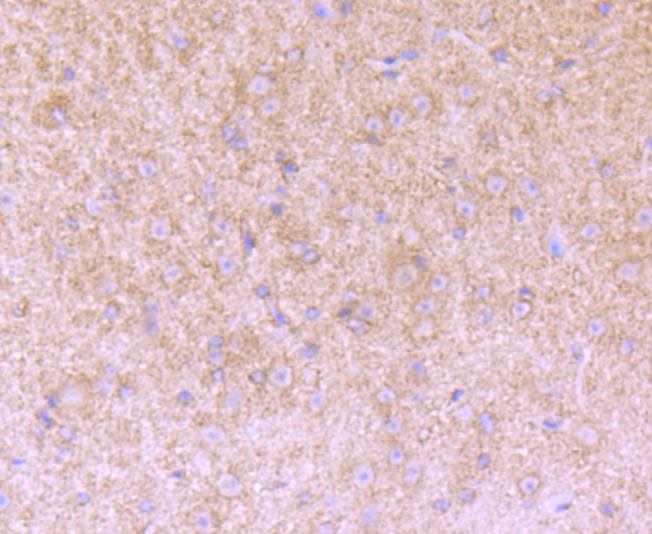 Immunohistochemical analysis of paraffin-embedded mouse brain tissue using anti-Versican antibody. The section was pre-treated using heat mediated antigen retrieval with Tris-EDTA buffer (pH 8.0-8.4) for 20 minutes.The tissues were blocked in 5% BSA for 30 minutes at room temperature, washed with ddH2O and PBS, and then probed with the primary antibody (ET7107-09, 1/50) for 30 minutes at room temperature. The detection was performed using an HRP conjugated compact polymer system. DAB was used as the chromogen. Tissues were counterstained with hematoxylin and mounted with DPX.