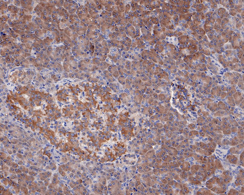 Immunohistochemical analysis of paraffin-embedded human pancreas tissue using anti-GARS antibody. The section was pre-treated using heat mediated antigen retrieval with Tris-EDTA buffer (pH 8.0-8.4) for 20 minutes.The tissues were blocked in 5% BSA for 30 minutes at room temperature, washed with ddH2O and PBS, and then probed with the primary antibody (ET1610-67, 1/50) for 30 minutes at room temperature. The detection was performed using an HRP conjugated compact polymer system. DAB was used as the chromogen. Tissues were counterstained with hematoxylin and mounted with DPX.
