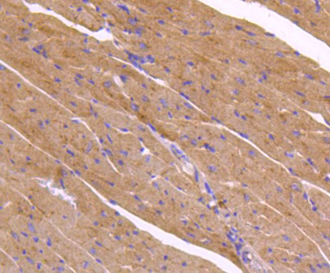 Immunohistochemical analysis of paraffin-embedded mouse heart tissue using anti-ATG9A antibody. The section was pre-treated using heat mediated antigen retrieval with Tris-EDTA buffer (pH 8.0-8.4) for 20 minutes.The tissues were blocked in 5% BSA for 30 minutes at room temperature, washed with ddH2O and PBS, and then probed with the primary antibody (ET1610-71, 1/50) for 30 minutes at room temperature. The detection was performed using an HRP conjugated compact polymer system. DAB was used as the chromogen. Tissues were counterstained with hematoxylin and mounted with DPX.