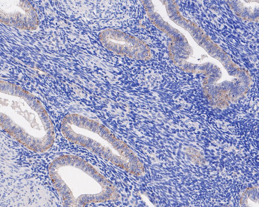 Immunohistochemical analysis of paraffin-embedded human endometrium tissue using anti-Junctional Adhesion Molecule 1 antibody. The section was pre-treated using heat mediated antigen retrieval with Tris-EDTA buffer (pH 8.0-8.4) for 20 minutes.The tissues were blocked in 5% BSA for 30 minutes at room temperature, washed with ddH2O and PBS, and then probed with the primary antibody (ET1610-90, 1/50) for 30 minutes at room temperature. The detection was performed using an HRP conjugated compact polymer system. DAB was used as the chromogen. Tissues were counterstained with hematoxylin and mounted with DPX.