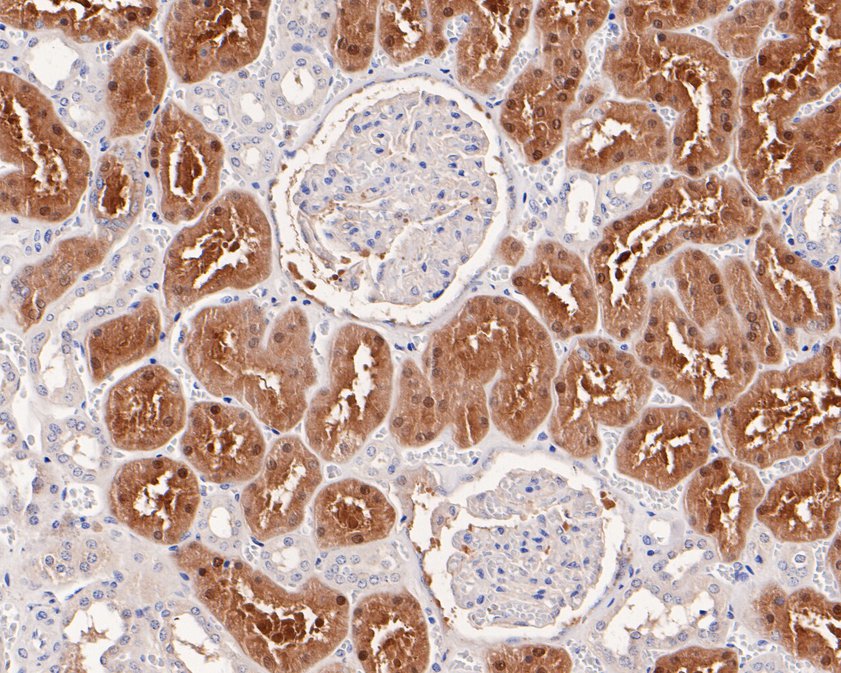 Immunohistochemical analysis of paraffin-embedded human kidney tissue using anti-NQO2 antibody. The section was pre-treated using heat mediated antigen retrieval with Tris-EDTA buffer (pH 8.0-8.4) for 20 minutes.The tissues were blocked in 5% BSA for 30 minutes at room temperature, washed with ddH2O and PBS, and then probed with the primary antibody (ET1610-92, 1/200) for 30 minutes at room temperature. The detection was performed using an HRP conjugated compact polymer system. DAB was used as the chromogen. Tissues were counterstained with hematoxylin and mounted with DPX.