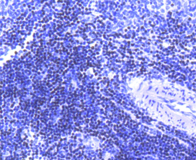 Immunohistochemical analysis of paraffin-embedded rat spleen tissue using anti-SATB1 antibody. <br />
<br />
The section was pre-treated using heat mediated antigen retrieval with Tris-EDTA buffer (pH 8.0-8.4) for 20 minutes.The tissues were blocked in 5% BSA for 30 minutes at room temperature, washed with ddH2O and PBS, and then probed with the primary antibody (ET1604-10, 1/50) for 30 minutes at room temperature. The detection was performed using an HRP conjugated compact polymer system. DAB was used as the chromogen. Tissues were counterstained with hematoxylin and mounted with DPX.
