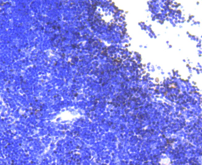 Immunohistochemical analysis of paraffin-embedded mouse thymus tissue using anti-SATB1 antibody. <br />
<br />
The section was pre-treated using heat mediated antigen retrieval with Tris-EDTA buffer (pH 8.0-8.4) for 20 minutes.The tissues were blocked in 5% BSA for 30 minutes at room temperature, washed with ddH2O and PBS, and then probed with the primary antibody (ET1604-10, 1/50) for 30 minutes at room temperature. The detection was performed using an HRP conjugated compact polymer system. DAB was used as the chromogen. Tissues were counterstained with hematoxylin and mounted with DPX.