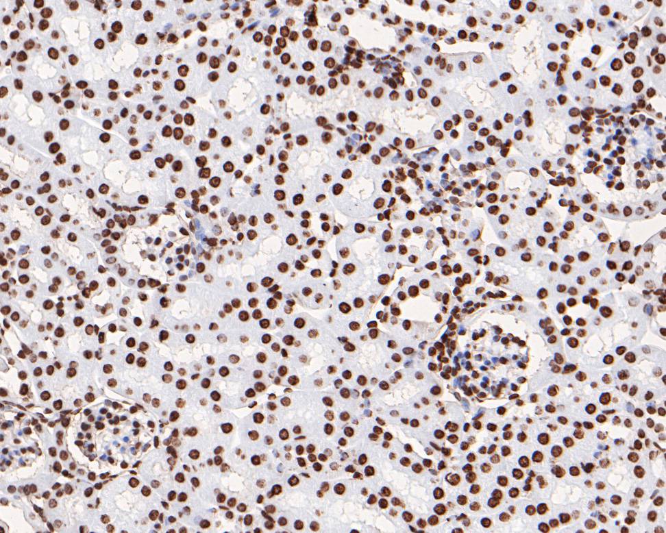 Immunohistochemical analysis of paraffin-embedded mouse kidney tissue using anti-Phospho-JAK2(Y1007+Y1008) antibody. The section was pre-treated using heat mediated antigen retrieval with sodium citrate buffer (pH 6.0) for 20 minutes. The tissues were blocked in 5% BSA for 30 minutes at room temperature, washed with ddH2O and PBS, and then probed with the primary antibody (ET1607-34, 1/200)  for 30 minutes at room temperature. The detection was performed using an HRP conjugated compact polymer system. DAB was used as the chromogen. Tissues were counterstained with hematoxylin and mounted with DPX.