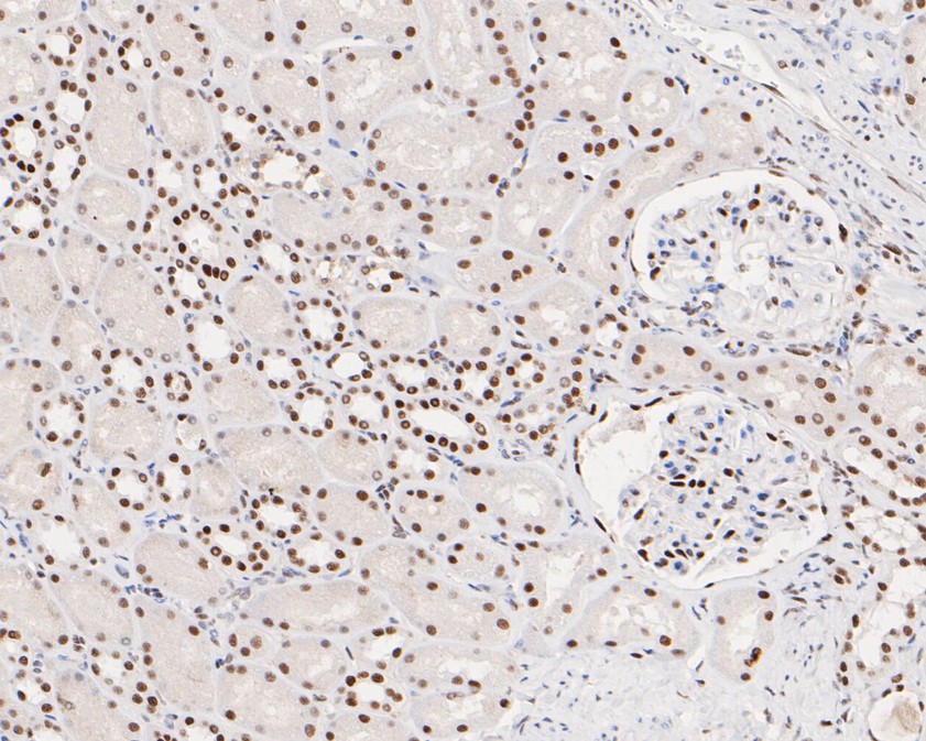 Immunohistochemical analysis of paraffin-embedded human kidney tissue using anti-MSH2 antibody. The section was pre-treated using heat mediated antigen retrieval with sodium citrate buffer (pH 6.0) for 20 minutes. The tissues were blocked in 5% BSA for 30 minutes at room temperature, washed with ddH2O and PBS, and then probed with the primary antibody (EM1801-04, 1/800)  for 30 minutes at room temperature. The detection was performed using an HRP conjugated compact polymer system. DAB was used as the chromogen. Tissues were counterstained with hematoxylin and mounted with DPX.