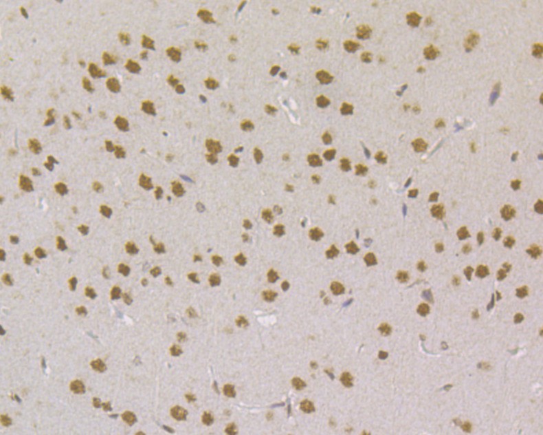 Immunohistochemical analysis of paraffin-embedded rat brain tissue using anti-MSH2 antibody. Counter stained with hematoxylin.  The section was pre-treated using heat mediated antigen retrieval with sodium citrate buffer (pH6) for 20 mins.