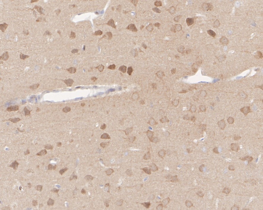 Immunohistochemical analysis of paraffin-embedded mouse brain tissue with Rabbit anti-PTEN antibody (ET1606-43) at 1/200 dilution.<br />
<br />
The section was pre-treated using heat mediated antigen retrieval with Tris-EDTA buffer (pH 9.0) for 20 minutes. The tissues were blocked in 1% BSA for 20 minutes at room temperature, washed with ddH2O and PBS, and then probed with the primary antibody (ET1606-43) at 1/200 dilution for 1 hour at room temperature. The detection was performed using an HRP conjugated compact polymer system. DAB was used as the chromogen. Tissues were counterstained with hematoxylin and mounted with DPX.