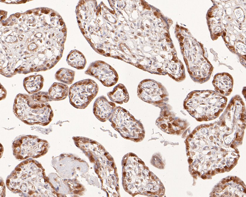 Immunohistochemical analysis of paraffin-embedded human placenta tissue using anti-FOXO4 antibody. The section was pre-treated using heat mediated antigen retrieval with sodium citrate buffer (pH 6.0) for 20 minutes. The tissues were blocked in 5% BSA for 30 minutes at room temperature, washed with ddH2O and PBS, and then probed with the primary antibody (ET1612-66, 1/50)  for 30 minutes at room temperature. The detection was performed using an HRP conjugated compact polymer system. DAB was used as the chromogen. Tissues were counterstained with hematoxylin and mounted with DPX.