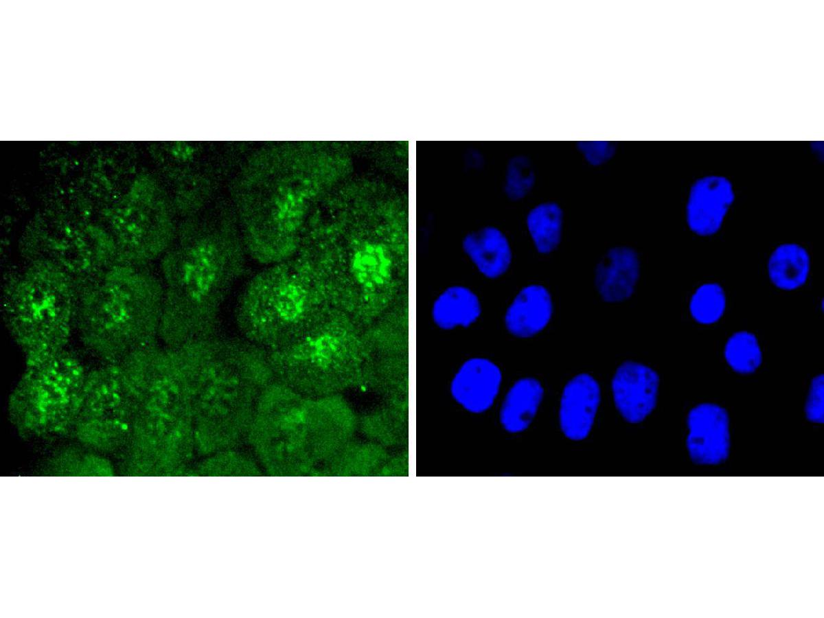 ICC staining of Phospho-Cdc6 (S54) in A431 cells (green). Formalin fixed cells were permeabilized with 0.1% Triton X-100 in TBS for 10 minutes at room temperature and blocked with 1% Blocker BSA for 15 minutes at room temperature. Cells were probed with the primary antibody (ET1612-96, 1/50) for 1 hour at room temperature, washed with PBS. Alexa Fluor®488 Goat anti-Rabbit IgG was used as the secondary antibody at 1/1,000 dilution. The nuclear counter stain is DAPI (blue).