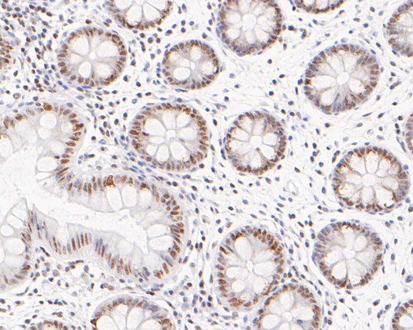 Immunohistochemical analysis of paraffin-embedded mouse colon tissue with Rabbit anti-HDAC1 antibody (ET1605-35) at 1/800 dilution.<br />
<br />
The section was pre-treated using heat mediated antigen retrieval with sodium citrate buffer (pH 6.0) for 2 minutes. The tissues were blocked in 1% BSA for 20 minutes at room temperature, washed with ddH2O and PBS, and then probed with the primary antibody (ET1605-35) at 1/800 dilution for 1 hour at room temperature. The detection was performed using an HRP conjugated compact polymer system. DAB was used as the chromogen. Tissues were counterstained with hematoxylin and mounted with DPX.