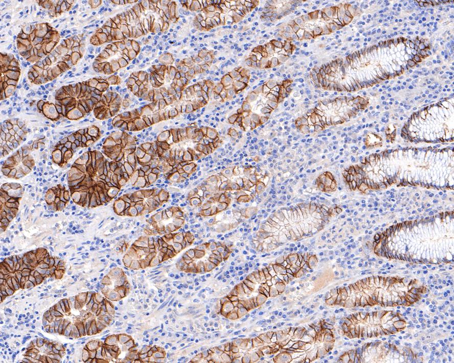 Immunohistochemical analysis of paraffin-embedded human stomach tissue with Rabbit anti-Carbonic anhydrase 9 antibody (ET1701-51) at 1/500 dilution.<br />
<br />
The section was pre-treated using heat mediated antigen retrieval with sodium citrate buffer (pH 6.0) for 2 minutes. The tissues were blocked in 1% BSA for 20 minutes at room temperature, washed with ddH2O and PBS, and then probed with the primary antibody (ET1701-51) at 1/500 dilution for 1 hour at room temperature. The detection was performed using an HRP conjugated compact polymer system. DAB was used as the chromogen. Tissues were counterstained with hematoxylin and mounted with DPX.