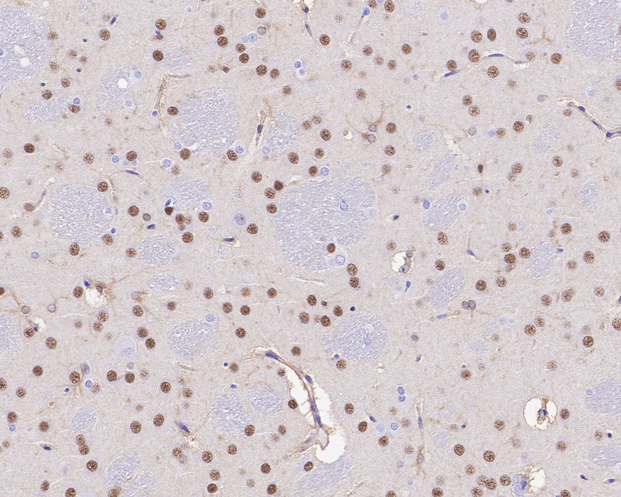 Immunohistochemical analysis of paraffin-embedded rat brain tissue with Rabbit anti-Ctip2 antibody (ET1702-76) at 1/1,000 dilution.<br />
<br />
The section was pre-treated using heat mediated antigen retrieval with sodium citrate buffer (pH 6.0) for 2 minutes. The tissues were blocked in 1% BSA for 20 minutes at room temperature, washed with ddH2O and PBS, and then probed with the primary antibody (ET1702-76) at 1/1,000 dilution for 1 hour at room temperature. The detection was performed using an HRP conjugated compact polymer system. DAB was used as the chromogen. Tissues were counterstained with hematoxylin and mounted with DPX.