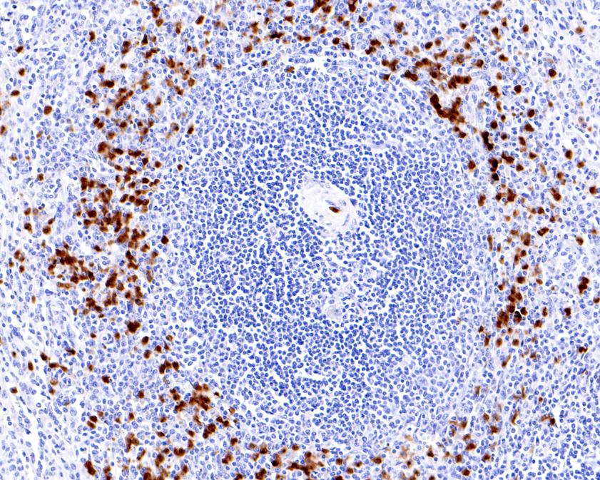 Immunohistochemical analysis of paraffin-embedded human spleen tissue using anti-S100P antibody. The section was pre-treated using heat mediated antigen retrieval with Tris-EDTA buffer (pH 8.0-8.4) for 20 minutes.The tissues were blocked in 5% BSA for 30 minutes at room temperature, washed with ddH2O and PBS, and then probed with the primary antibody (ET1702-82, 1/200) for 30 minutes at room temperature. The detection was performed using an HRP conjugated compact polymer system. DAB was used as the chromogen. Tissues were counterstained with hematoxylin and mounted with DPX.