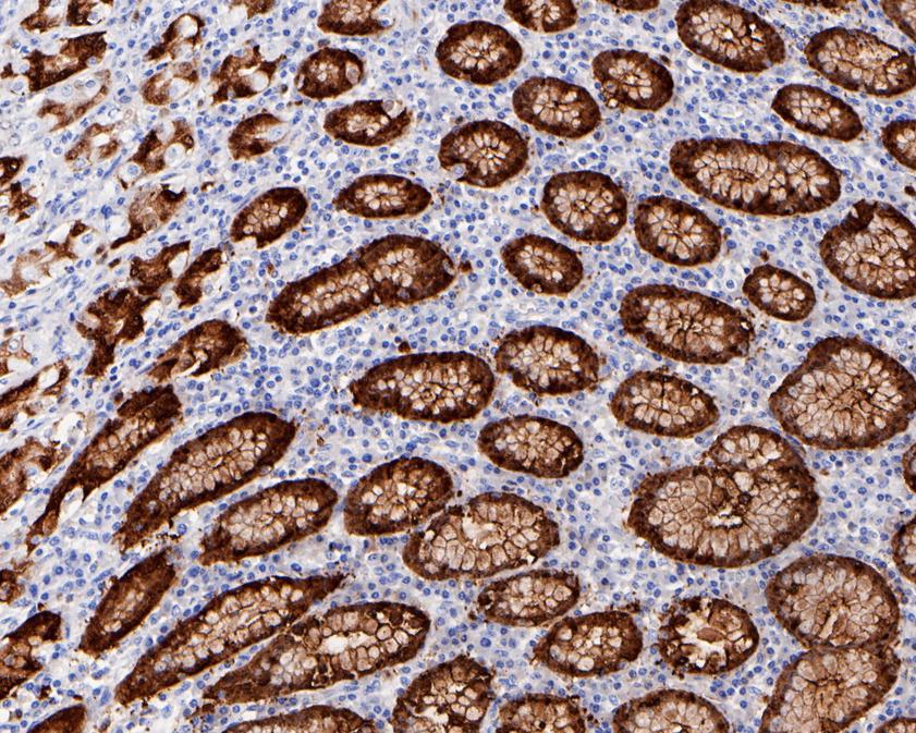 Immunohistochemical analysis of paraffin-embedded human stomach  tissue using anti-S100P antibody. The section was pre-treated using heat mediated antigen retrieval with Tris-EDTA buffer (pH 8.0-8.4) for 20 minutes.The tissues were blocked in 5% BSA for 30 minutes at room temperature, washed with ddH2O and PBS, and then probed with the primary antibody (ET1702-82, 1/200) for 30 minutes at room temperature. The detection was performed using an HRP conjugated compact polymer system. DAB was used as the chromogen. Tissues were counterstained with hematoxylin and mounted with DPX.