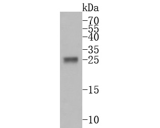 Western blot analysis of PRSS2 on human small intestine tissue lysates. Proteins were transferred to a PVDF membrane and blocked with 5% BSA in PBS for 1 hour at room temperature. The primary antibody (HA500182, 1/500) was used in 5% BSA at room temperature for 2 hours. Goat Anti-Rabbit IgG - HRP Secondary Antibody (HA1001) at 1:200,000 dilution was used for 1 hour at room temperature.