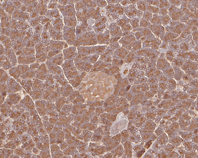 Immunohistochemical analysis of paraffin-embedded rat pancreas tissue using anti-PRSS2 antibody. The section was pre-treated using heat mediated antigen retrieval with Tris-EDTA buffer (pH 9.0) for 20 minutes.The tissues were blocked in 5% BSA for 30 minutes at room temperature, washed with ddH2O and PBS, and then probed with the primary antibody (HA500182, 1/800) for 30 minutes at room temperature. The detection was performed using an HRP conjugated compact polymer system. DAB was used as the chromogen. Tissues were counterstained with hematoxylin and mounted with DPX.