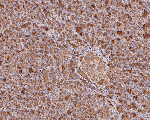 Immunohistochemical analysis of paraffin-embedded human pancreas tissue using anti-PRSS2 antibody. The section was pre-treated using heat mediated antigen retrieval with Tris-EDTA buffer (pH 9.0) for 20 minutes.The tissues were blocked in 5% BSA for 30 minutes at room temperature, washed with ddH2O and PBS, and then probed with the primary antibody (HA500182, 1/800) for 30 minutes at room temperature. The detection was performed using an HRP conjugated compact polymer system. DAB was used as the chromogen. Tissues were counterstained with hematoxylin and mounted with DPX.