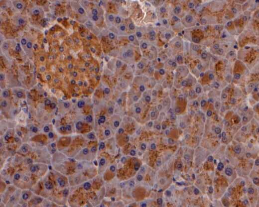 Immunohistochemical analysis of paraffin-embedded mouse pancreas tissue using anti-PRSS2 antibody. The section was pre-treated using heat mediated antigen retrieval with Tris-EDTA buffer (pH 9.0) for 20 minutes.The tissues were blocked in 5% BSA for 30 minutes at room temperature, washed with ddH2O and PBS, and then probed with the primary antibody (HA500182, 1/200) for 30 minutes at room temperature. The detection was performed using an HRP conjugated compact polymer system. DAB was used as the chromogen. Tissues were counterstained with hematoxylin and mounted with DPX.