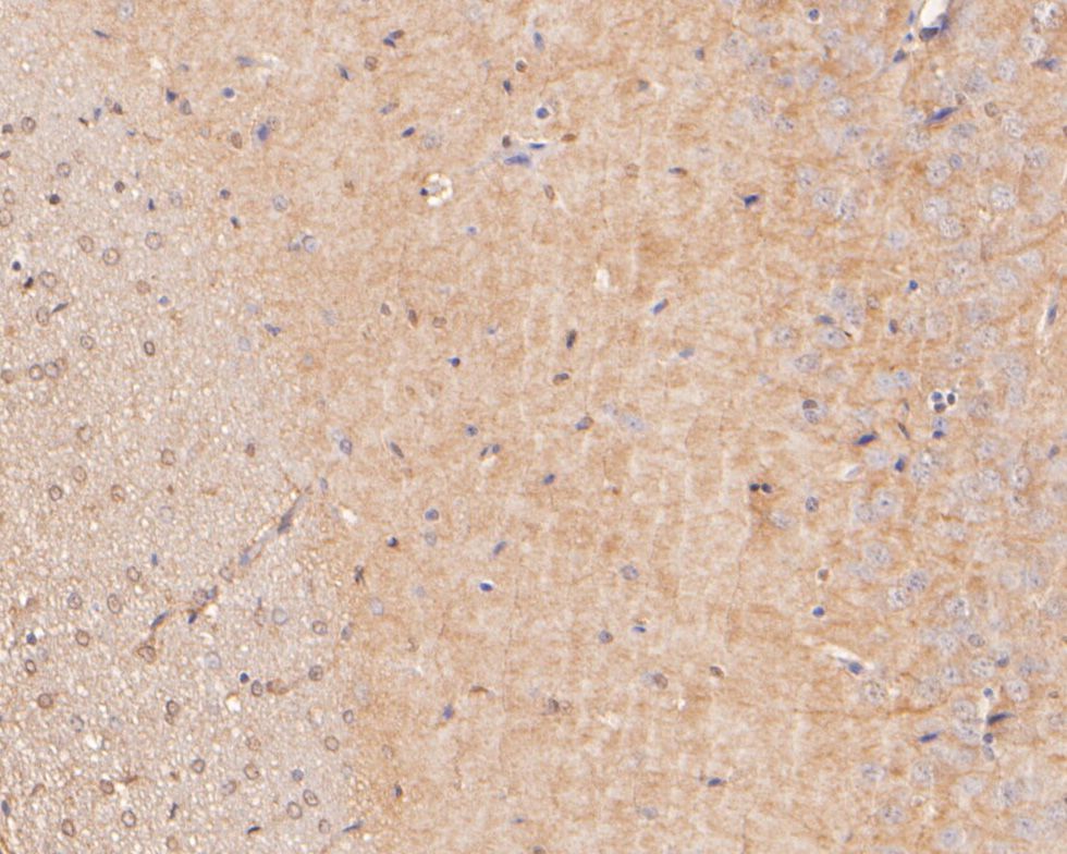Neurabin 1 Rabbit Polyclonal Antibody - image 2