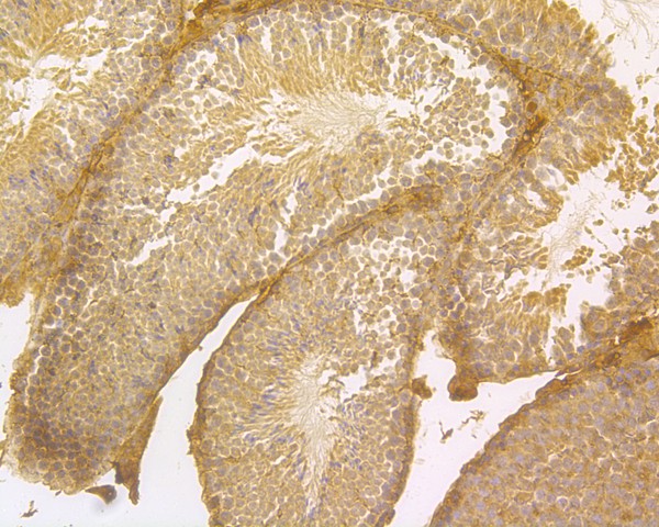 Immunohistochemical analysis of paraffin-embedded mouse testis tissue using anti-ENAH antibody. The section was pre-treated using heat mediated antigen retrieval with Tris-EDTA buffer (pH 9.0) for 20 minutes.The tissues were blocked in 5% BSA for 30 minutes at room temperature, washed with ddH2O and PBS, and then probed with the primary antibody (HA500168, 1/800) for 30 minutes at room temperature. The detection was performed using an HRP conjugated compact polymer system. DAB was used as the chromogen. Tissues were counterstained with hematoxylin and mounted with DPX.