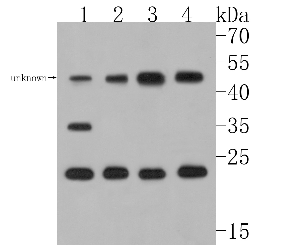 Western blot analysis of Myelin PLP on different lysates. Proteins were transferred to a PVDF membrane and blocked with 5% BSA in PBS for 1 hour at room temperature. The primary antibody (HA500202, 1/500) was used in 5% BSA at room temperature for 2 hours. Goat Anti-Rabbit IgG - HRP Secondary Antibody (HA1001) at 1:5,000 dilution was used for 1 hour at room temperature.<br />
Positive control: <br />
Lane 1: HepG2 cell lysate<br />
Lane 2: Mouse cerebellum tissue lysate<br />
Lane 3: Mouse brain tissue lysate<br />
Lane 4: Rat brain tissue lysate