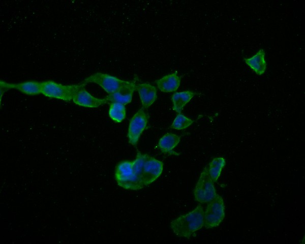 ICC staining of Myelin PLP in F9 cells (green). Formalin fixed cells were permeabilized with 0.1% Triton X-100 in TBS for 10 minutes at room temperature and blocked with 1% Blocker BSA for 15 minutes at room temperature. Cells were probed with the primary antibody (HA500202, 1/50) for 1 hour at room temperature, washed with PBS. Alexa Fluor®488 Goat anti-Rabbit IgG was used as the secondary antibody at 1/1,000 dilution. The nuclear counter stain is DAPI (blue).