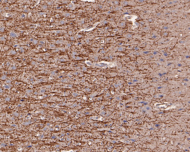 Immunohistochemical analysis of paraffin-embedded rat brain tissue using anti-Myelin PLP antibody. The section was pre-treated using heat mediated antigen retrieval with Tris-EDTA buffer (pH 8.0-8.4) for 20 minutes.The tissues were blocked in 5% BSA for 30 minutes at room temperature, washed with ddH2O and PBS, and then probed with the primary antibody (HA500202, 1/400) for 30 minutes at room temperature. The detection was performed using an HRP conjugated compact polymer system. DAB was used as the chromogen. Tissues were counterstained with hematoxylin and mounted with DPX.